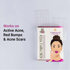 Acne Pimple Patches