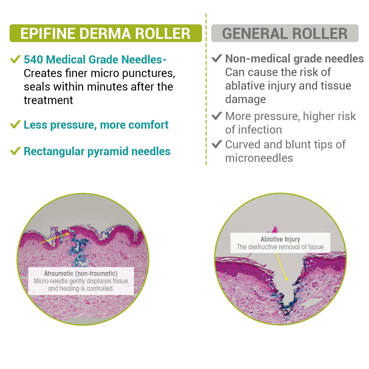 Epifine Derma Roller | 540 0.5mm Medical Grade Stainless Steel Needles